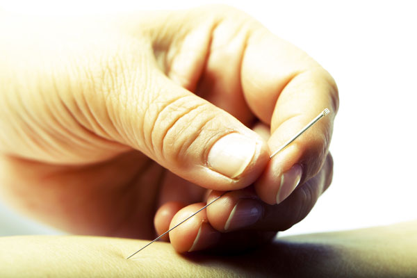 Acupuncture at Theorem health